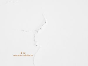 Imperfection / Isabelle Ruiz-Dammron / Soins Intuitifs